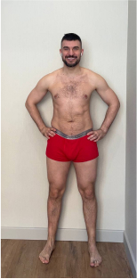 transformation-img