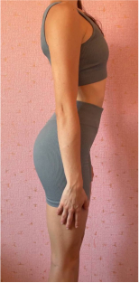 transformation-img