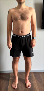 transformation-img