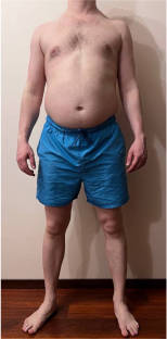 transformation-img